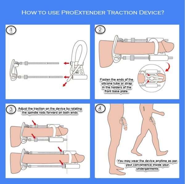 Proextender_3 Extensor de Pene Pro Extender